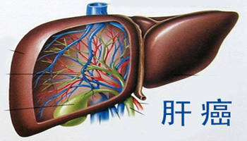 肝癌治疗费用大概多少钱